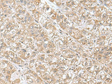 EIF1AY Polyclonal Antibody