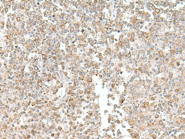 EIF1AY Polyclonal Antibody