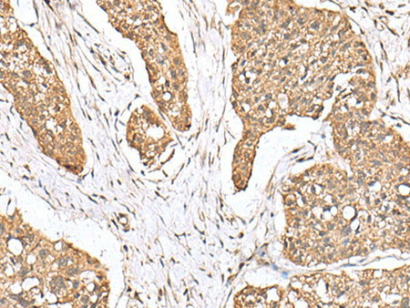 PLA2G2A Polyclonal Antibody Reactivity Human