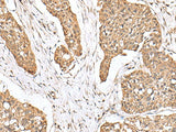 PLA2G2A Polyclonal Antibody Reactivity Human