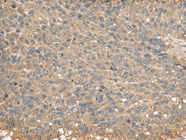 PLA2G2A Polyclonal Antibody Reactivity Human