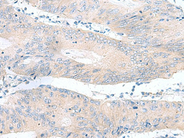 RPS16 Polyclonal Antibody Reactivity Human