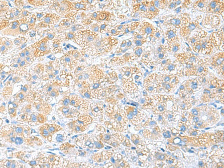 RPS16 Polyclonal Antibody Reactivity Human