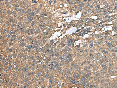 AHNAK Polyclonal Antibody Reactivity Human