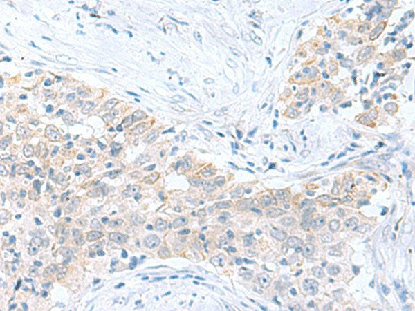 PDE6D Polyclonal Antibody Reactivity Human
