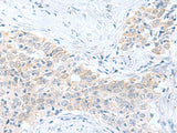 PDE6D Polyclonal Antibody Reactivity Human