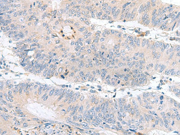 PDE6D Polyclonal Antibody Reactivity Human