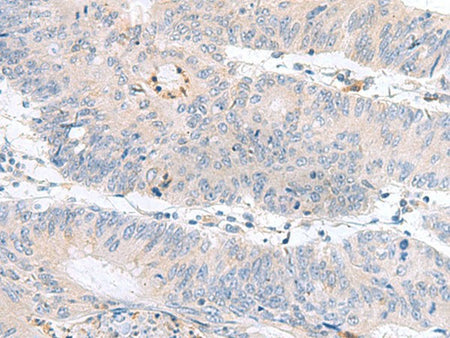 PDE6D Polyclonal Antibody Reactivity Human