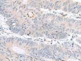 PDE6D Polyclonal Antibody Reactivity Human