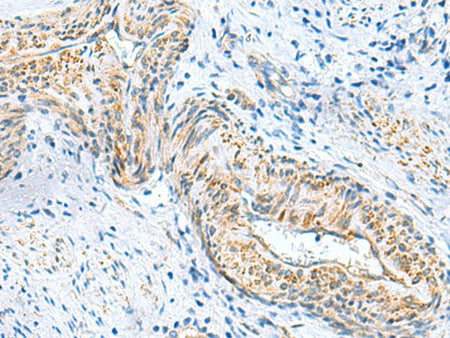MYL1 Polyclonal Antibody Reactivity Human