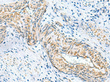 MYL1 Polyclonal Antibody Reactivity Human