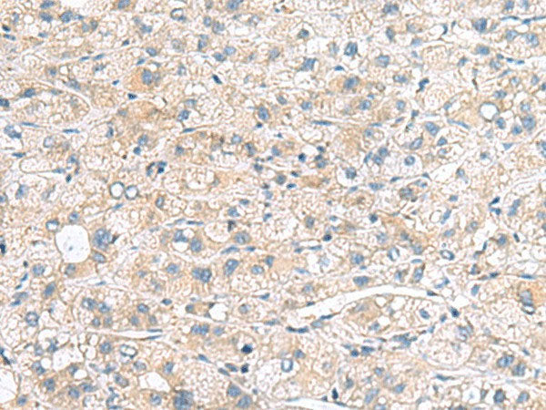 MYL1 Polyclonal Antibody Reactivity Human