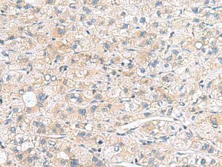 MYL1 Polyclonal Antibody Reactivity Human