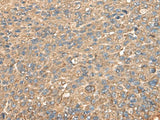 RPS14 Polyclonal Antibody Reactivity Human