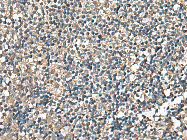 RPS14 Polyclonal Antibody Reactivity Human