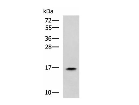 RPS14 Polyclonal Antibody Reactivity Human
