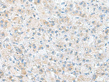 DNAL1 Polyclonal Antibody Reactivity Human
