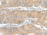 DNAL1 Polyclonal Antibody Reactivity Human