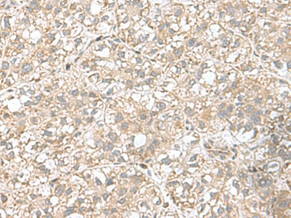 CPLX3 Polyclonal Antibody Reactivity Human