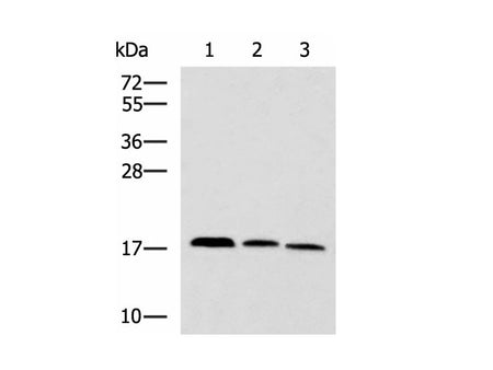 CPLX3 Polyclonal Antibody Reactivity Human