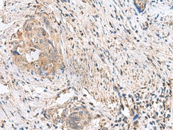 STK32A Polyclonal Antibody Reactivity Human