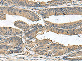 ZG16 Polyclonal Antibody Reactivity Human