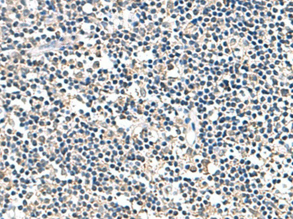 ATP5F1D Polyclonal Antibody Reactivity Human