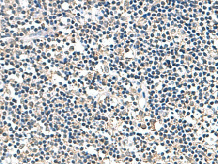 ATP5F1D Polyclonal Antibody Reactivity Human