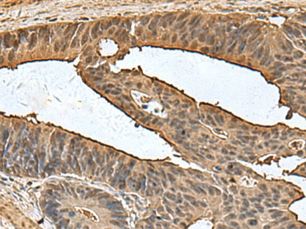 DCTPP1 Polyclonal Antibody Reactivity Human