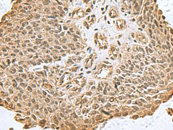DCTPP1 Polyclonal Antibody Reactivity Human