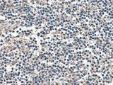 BLOC1S6 Polyclonal Antibody Reactivity Human
