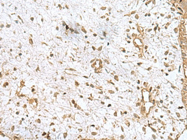 AK6 Polyclonal Antibody Reactivity Human