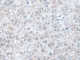 TXNDC12 Polyclonal Antibody Reactivity Human
