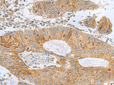 TXNDC12 Polyclonal Antibody Reactivity Human