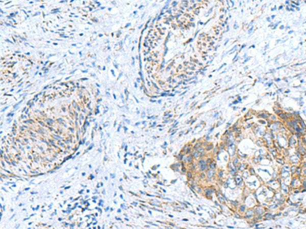 GCSH Polyclonal Antibody Reactivity Human