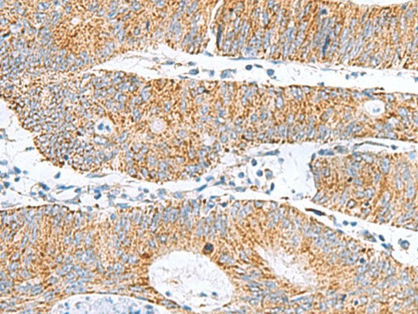 GCSH Polyclonal Antibody Reactivity Human