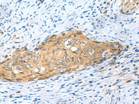 MYDGF Polyclonal Antibody Reactivity Human