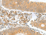 MYDGF Polyclonal Antibody Reactivity Human