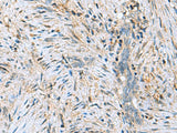 DNPH1 Polyclonal Antibody Reactivity Human