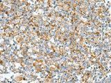 DNPH1 Polyclonal Antibody Reactivity Human, Biomarkers, Elabscience Biotechnology, MSE Supplies