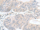 NMU Polyclonal Antibody Reactivity Human