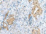 NMU Polyclonal Antibody Reactivity Human