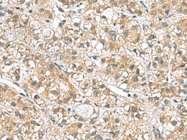 PPIH Polyclonal Antibody Reactivity Human