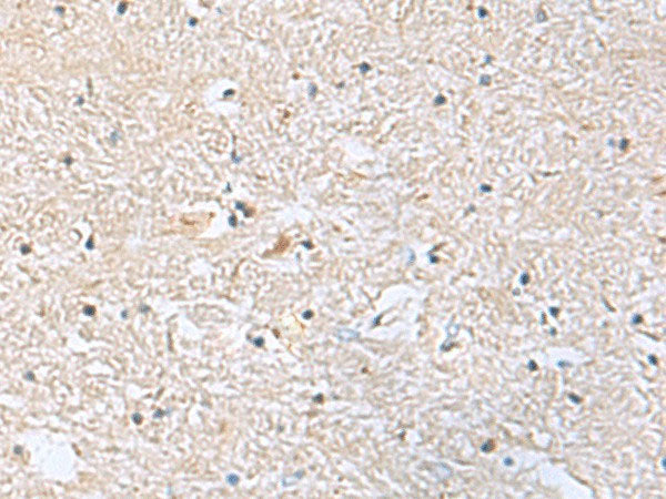 EIF4A2 Polyclonal Antibody Reactivity Human