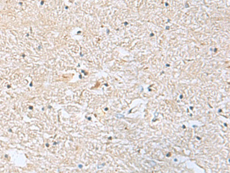 EIF4A2 Polyclonal Antibody Reactivity Human