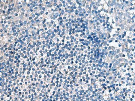 EIF4A2 Polyclonal Antibody Reactivity Human