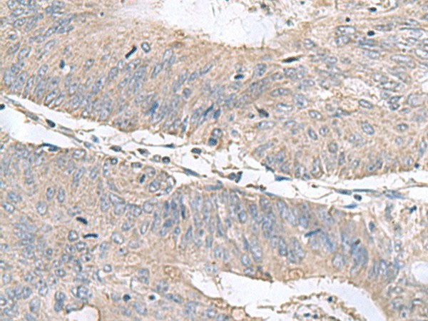 RNF208 Polyclonal Antibody Reactivity Human, Biomarkers, Elabscience Biotechnology, MSE Supplies
