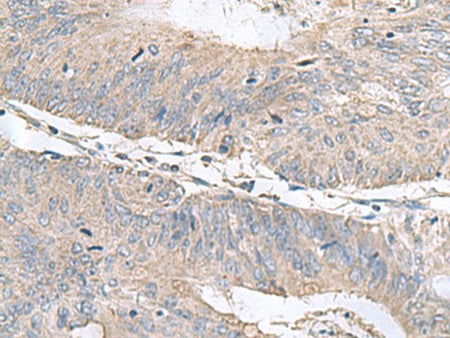 RNF208 Polyclonal Antibody Reactivity Human, Biomarkers, Elabscience Biotechnology, MSE Supplies