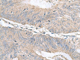 RNF208 Polyclonal Antibody Reactivity Human, Biomarkers, Elabscience Biotechnology, MSE Supplies