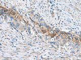 RNF208 Polyclonal Antibody Reactivity Human, Biomarkers, Elabscience Biotechnology, MSE Supplies